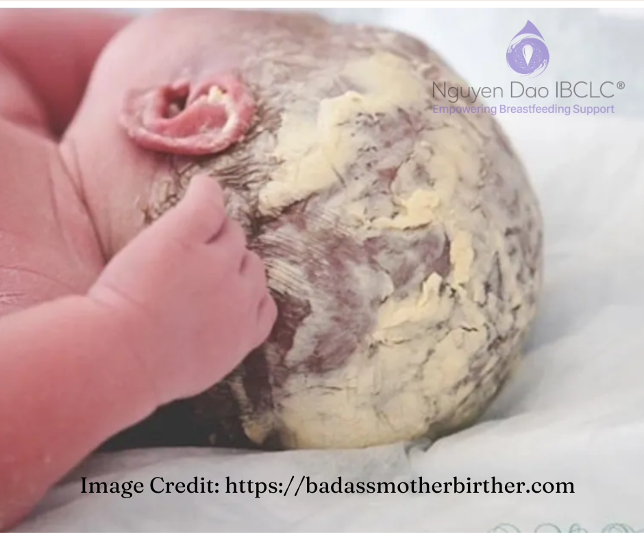Những công dụng tuyệt vời ít ai biết của lớp sáp/gây ở trẻ sơ sinh post thumbnail image